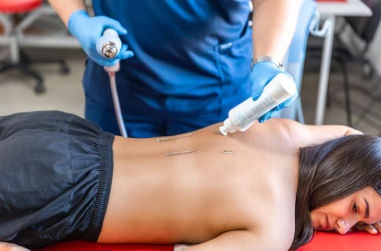 Who Offers the Best PDRN Treatment in Noida?