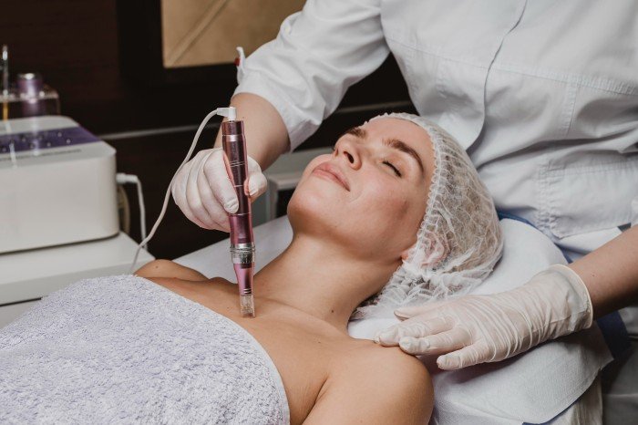 Why Choose the Best Fractional CO2 Laser Treatment for Acne Scars?