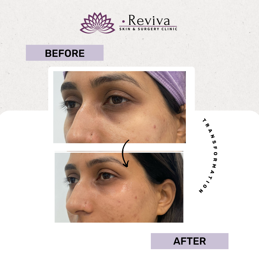 Anti-ageing treatment before and after
