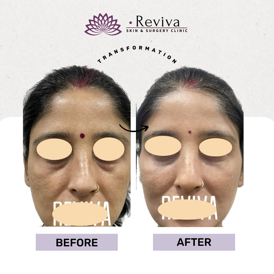 Anti-ageing treatment before and after