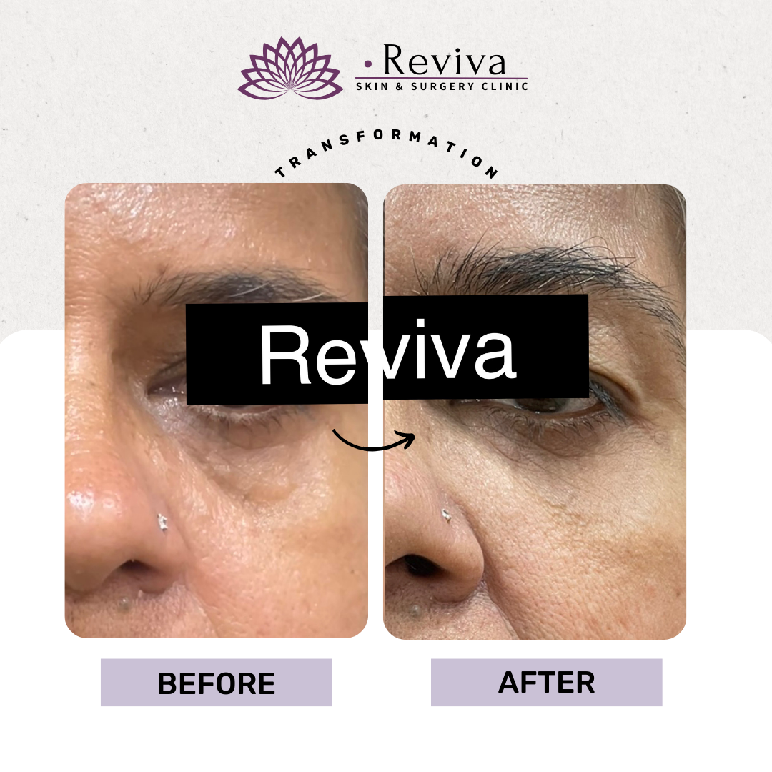 Anti-ageing treatment before and after