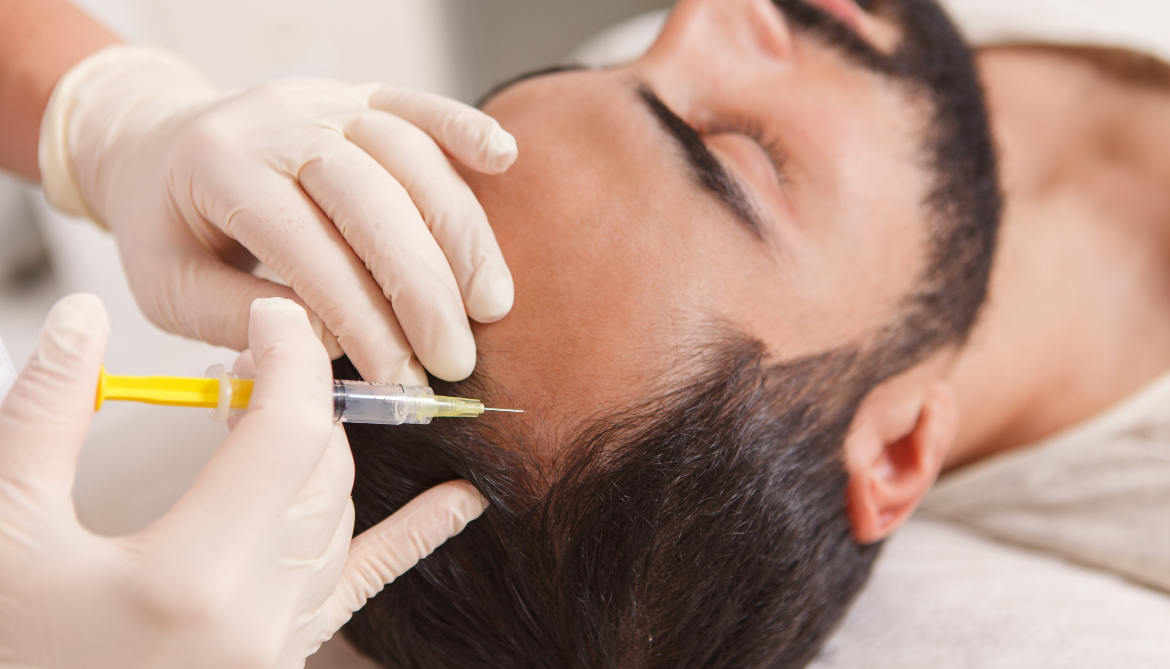 Hair Transplant